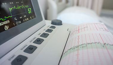 Post-partum haemorrhage